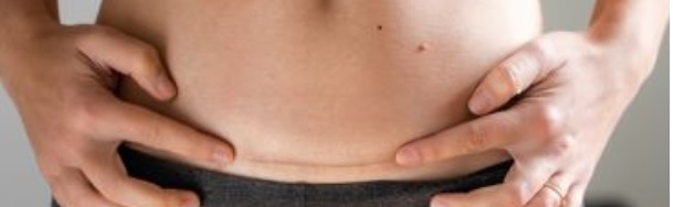 Katanya, ERACS ga dijahit ?