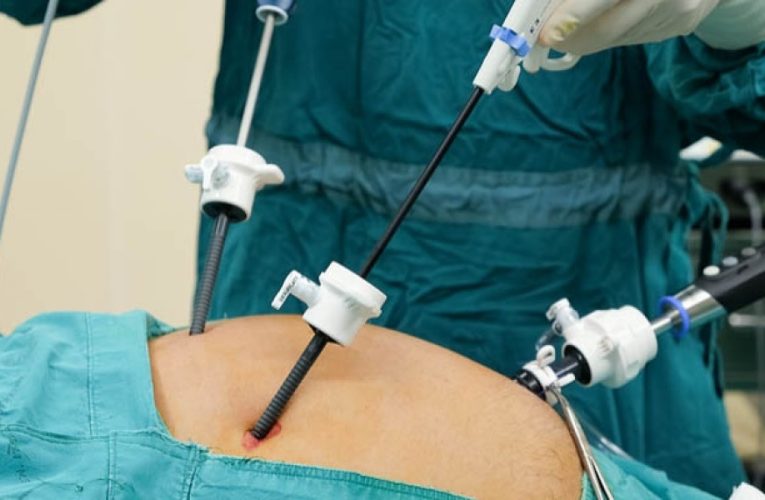 “Kalau Harus Operasi, Kenapa Tidak Laparoskopi Saja di RSUD Jatisari?”